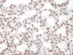 BCL11B Antibody, Novus Biologicals 0.1mL; Unlabeled:Antibodies, Polyclonal